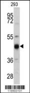 Keratin 13 antibody, 62-415, ProSci, Western Blot image 