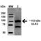 Unc-51 Like Autophagy Activating Kinase 2 antibody, SPC-641D-A594, StressMarq, Western Blot image 