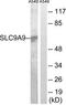 Solute Carrier Family 9 Member A9 antibody, TA316321, Origene, Western Blot image 