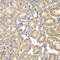 Proteasome 26S Subunit, Non-ATPase 9 antibody, 19-611, ProSci, Immunohistochemistry paraffin image 