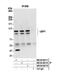 Ubiquitin carboxyl-terminal hydrolase 1 antibody, NB100-88117, Novus Biologicals, Western Blot image 