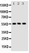 Solute Carrier Family 2 Member 5 antibody, PA1737, Boster Biological Technology, Western Blot image 