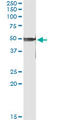 Protein Kinase X-Linked antibody, LS-C198002, Lifespan Biosciences, Immunoprecipitation image 