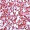 Glutamate Metabotropic Receptor 1 antibody, PA5-32493, Invitrogen Antibodies, Immunohistochemistry paraffin image 