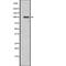 Leucine Rich Repeat Containing G Protein-Coupled Receptor 5 antibody, abx147549, Abbexa, Western Blot image 