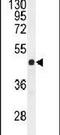 Gasdermin C antibody, PA5-24259, Invitrogen Antibodies, Western Blot image 