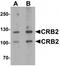 Crumbs Cell Polarity Complex Component 2 antibody, TA320165, Origene, Western Blot image 