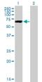 Protein Phosphatase 2 Regulatory Subunit Bgamma antibody, H00005522-B01P, Novus Biologicals, Western Blot image 