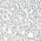 Ornithine Carbamoyltransferase antibody, 23-932, ProSci, Immunohistochemistry paraffin image 