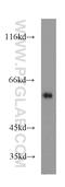 Coactivator Associated Arginine Methyltransferase 1 antibody, 55246-1-AP, Proteintech Group, Western Blot image 