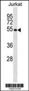 CAMP Responsive Element Binding Protein 3 antibody, 60-832, ProSci, Western Blot image 