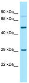 G Protein Subunit Alpha 13 antibody, TA331257, Origene, Western Blot image 