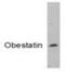 Ghrelin And Obestatin Prepropeptide antibody, GTX79314, GeneTex, Western Blot image 