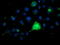 Fibroblast growth factor receptor 2 antibody, TA503137, Origene, Immunofluorescence image 
