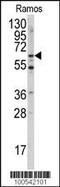 Menin 1 antibody, 62-893, ProSci, Western Blot image 