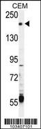 Transient Receptor Potential Cation Channel Subfamily M Member 6 antibody, 63-369, ProSci, Western Blot image 