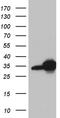 Dehydrogenase/Reductase 4 Like 2 antibody, TA810279, Origene, Western Blot image 