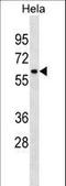 Zinc Finger Protein 410 antibody, LS-C157059, Lifespan Biosciences, Western Blot image 