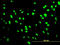 Upstream Binding Transcription Factor antibody, LS-B6167, Lifespan Biosciences, Immunofluorescence image 