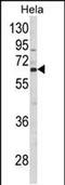 CTP Synthase 2 antibody, PA5-49639, Invitrogen Antibodies, Western Blot image 