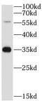 ATPase H+/K+ Transporting Subunit Beta antibody, FNab00701, FineTest, Western Blot image 