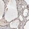 RecQ Like Helicase 4 antibody, NBP2-47310, Novus Biologicals, Immunohistochemistry paraffin image 