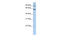 Chaperonin Containing TCP1 Subunit 5 antibody, 26-932, ProSci, Enzyme Linked Immunosorbent Assay image 