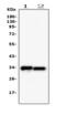 Phosphopantothenoylcysteine Synthetase antibody, M05567, Boster Biological Technology, Western Blot image 