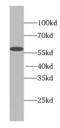 Tetratricopeptide Repeat Domain 31 antibody, FNab09081, FineTest, Western Blot image 
