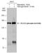 1-phosphatidylinositol-4,5-bisphosphate phosphodiesterase gamma-1 antibody, GTX133530, GeneTex, Western Blot image 