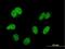 Cullin Associated And Neddylation Dissociated 1 antibody, H00055832-M04, Novus Biologicals, Immunofluorescence image 