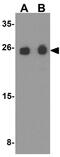 Small Nuclear Ribonucleoprotein Polypeptide N antibody, GTX31617, GeneTex, Western Blot image 