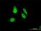 Rhox Homeobox Family Member 1 antibody, H00158800-M01, Novus Biologicals, Immunofluorescence image 