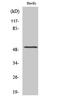 Hepatocyte Nuclear Factor 4 Alpha antibody, A00389S313-1, Boster Biological Technology, Western Blot image 