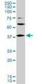 LIM/homeobox protein Lhx6 antibody, H00026468-M01, Novus Biologicals, Western Blot image 
