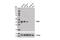 Tribbles Pseudokinase 2 antibody, 13533S, Cell Signaling Technology, Western Blot image 