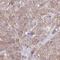 Chromosome 19 Open Reading Frame 54 antibody, HPA059043, Atlas Antibodies, Immunohistochemistry paraffin image 