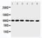 Protein Inhibitor Of Activated STAT 1 antibody, PA2252, Boster Biological Technology, Western Blot image 