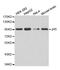 Nibrin antibody, MBS126046, MyBioSource, Western Blot image 