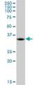 Malate Dehydrogenase 1 antibody, H00004190-M01, Novus Biologicals, Western Blot image 