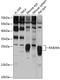 RAB39A, Member RAS Oncogene Family antibody, 14-324, ProSci, Western Blot image 
