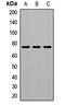 Galactosylceramidase antibody, LS-C667807, Lifespan Biosciences, Western Blot image 