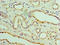 Aspartate Beta-Hydroxylase antibody, A54361-100, Epigentek, Immunohistochemistry paraffin image 