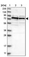 DnaJ Heat Shock Protein Family (Hsp40) Member C2 antibody, PA5-54212, Invitrogen Antibodies, Western Blot image 