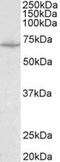 Solute Carrier Family 6 Member 8 antibody, MBS422659, MyBioSource, Western Blot image 