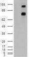 Patched 1 antibody, GTX83771, GeneTex, Western Blot image 