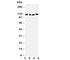 ATPase Sarcoplasmic/Endoplasmic Reticulum Ca2+ Transporting 2 antibody, R30810, NSJ Bioreagents, Western Blot image 