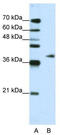 Adenosine Deaminase TRNA Specific 1 antibody, TA343780, Origene, Western Blot image 