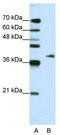 Adenosine Deaminase TRNA Specific 1 antibody, TA343780, Origene, Western Blot image 