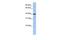 Pellino E3 Ubiquitin Protein Ligase Family Member 3 antibody, GTX45398, GeneTex, Western Blot image 